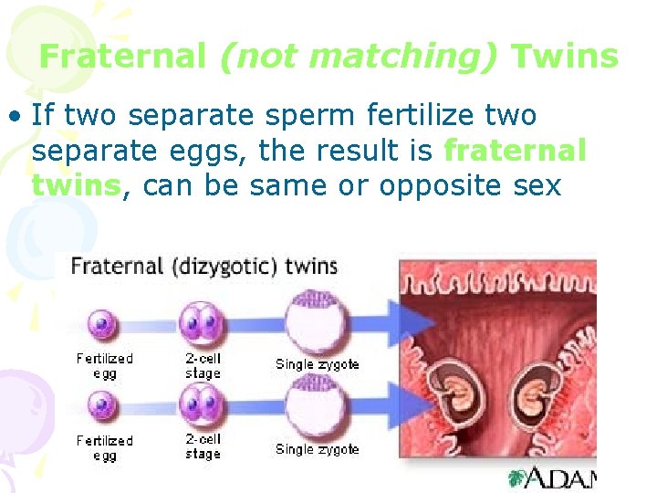 Fraternal (not matching) Twins • If two separate sperm fertilize two separate eggs, the