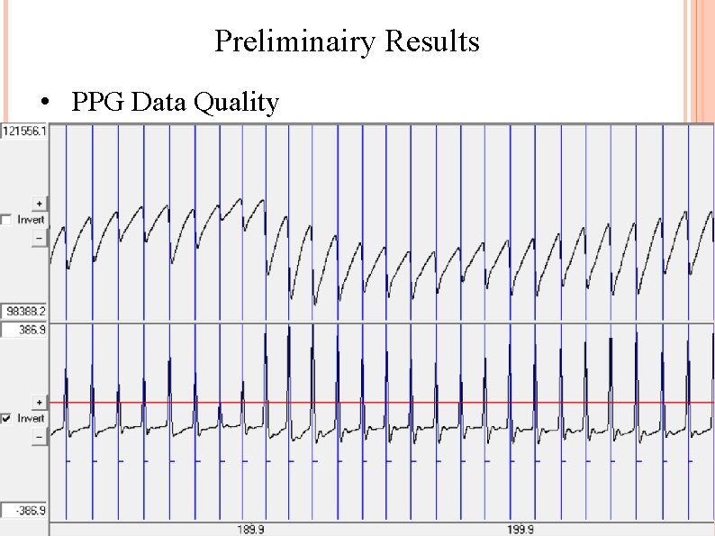 Preliminairy Results • PPG Data Quality 