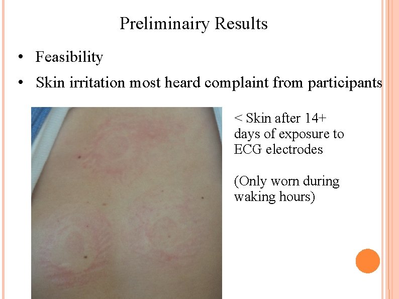 Preliminairy Results • Feasibility • Skin irritation most heard complaint from participants < Skin