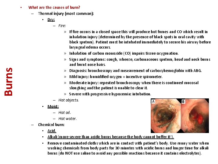 Burns • What are the causes of burn? – Thermal injury (most common): •
