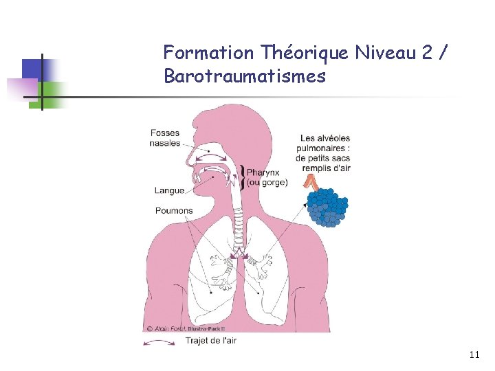 Formation Théorique Niveau 2 / Barotraumatismes 11 