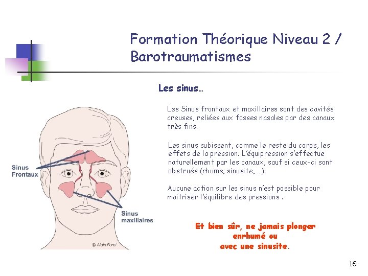 Formation Théorique Niveau 2 / Barotraumatismes Les sinus… Les Sinus frontaux et maxillaires sont