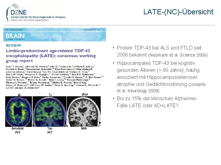 LATE-(NC)-Übersicht • Protein TDP-43 bei ALS und FTLD seit 2006 bekannt (Neumann et al.