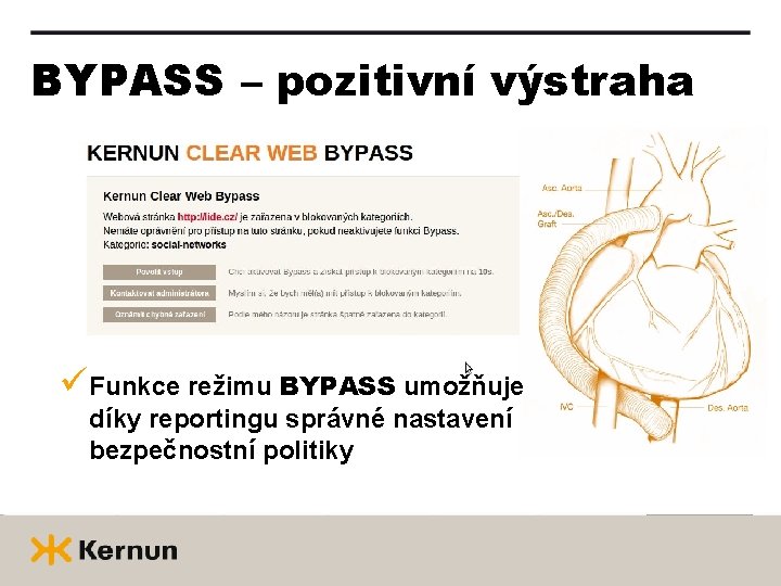 BYPASS – pozitivní výstraha üFunkce režimu BYPASS umožňuje díky reportingu správné nastavení bezpečnostní politiky