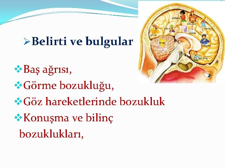 ØBelirti ve bulgular v. Baş ağrısı, v. Görme bozukluğu, v. Göz hareketlerinde bozukluk v.