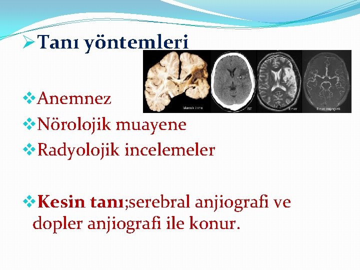 ØTanı yöntemleri v. Anemnez v. Nörolojik muayene v. Radyolojik incelemeler v. Kesin tanı; serebral