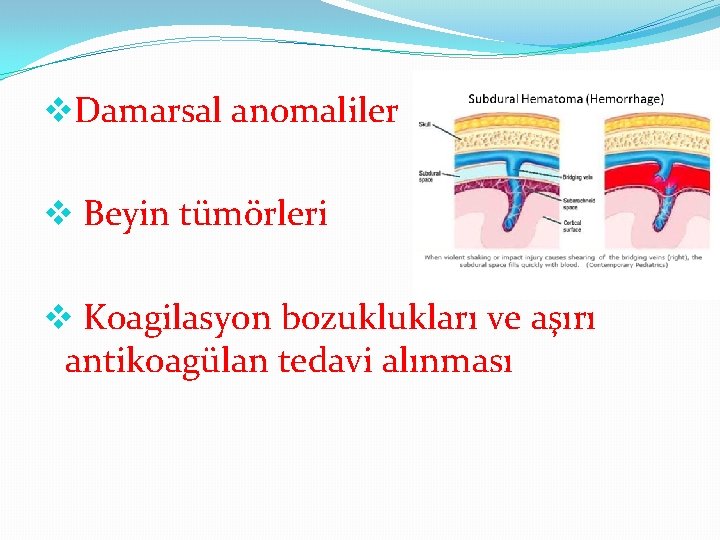 v. Damarsal anomaliler v Beyin tümörleri v Koagilasyon bozuklukları ve aşırı antikoagülan tedavi alınması