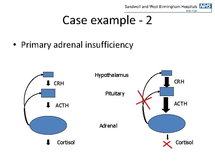 Case example - 2 • Primary adrenal insufficiency Hypothalamus CRH Pituitary ACTH Adrenal Cortisol