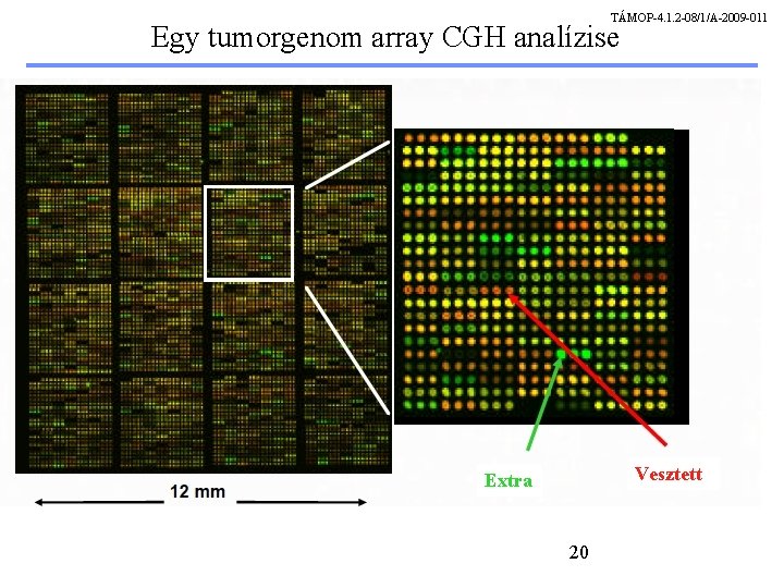 TÁMOP-4. 1. 2 -08/1/A-2009 -011 Egy tumorgenom array CGH analízise Vesztett Extra 20 