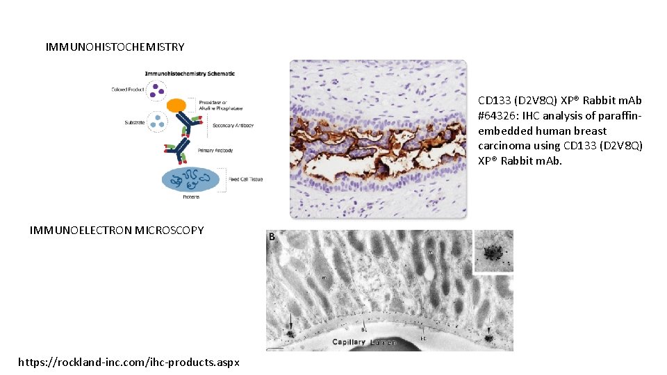 IMMUNOHISTOCHEMISTRY CD 133 (D 2 V 8 Q) XP® Rabbit m. Ab #64326: IHC