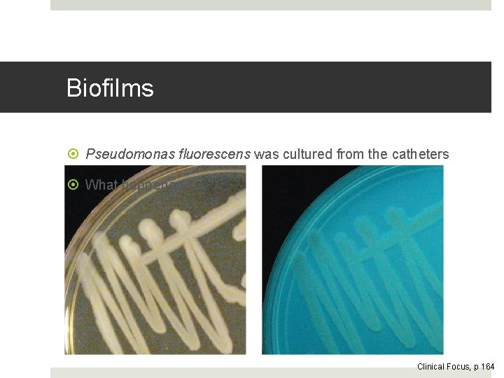 Biofilms Pseudomonas fluorescens was cultured from the catheters What happened? Clinical Focus, p 164