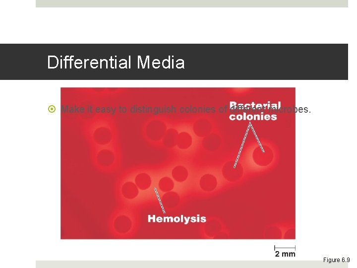 Differential Media Make it easy to distinguish colonies of different microbes. Figure 6. 9