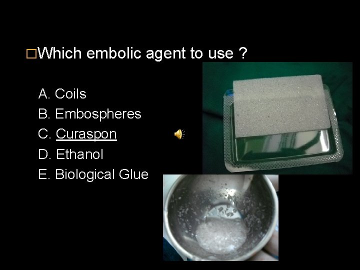 �Which embolic agent to use ? A. Coils B. Embospheres C. Curaspon D. Ethanol