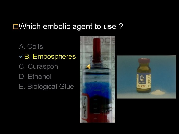 �Which embolic agent to use ? A. Coils ü B. Embospheres C. Curaspon D.