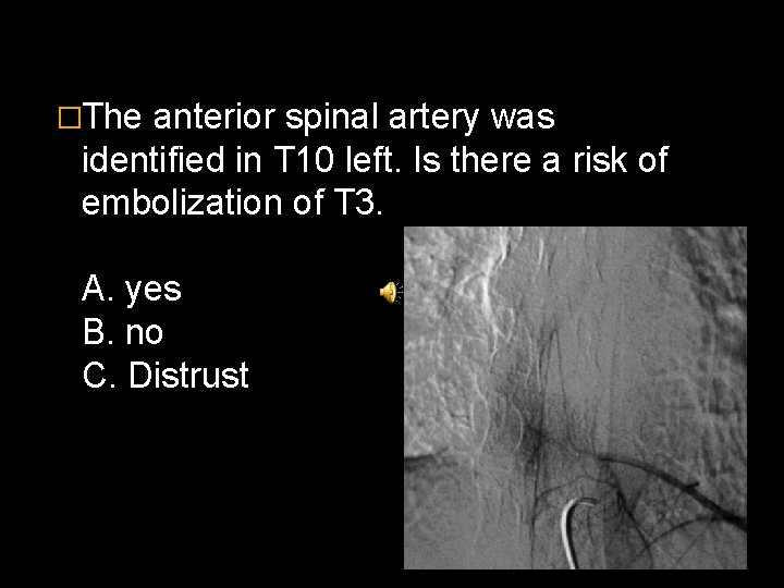 �The anterior spinal artery was identified in T 10 left. Is there a risk