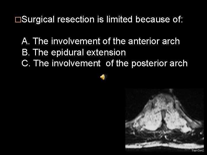 �Surgical resection is limited because of: A. The involvement of the anterior arch B.