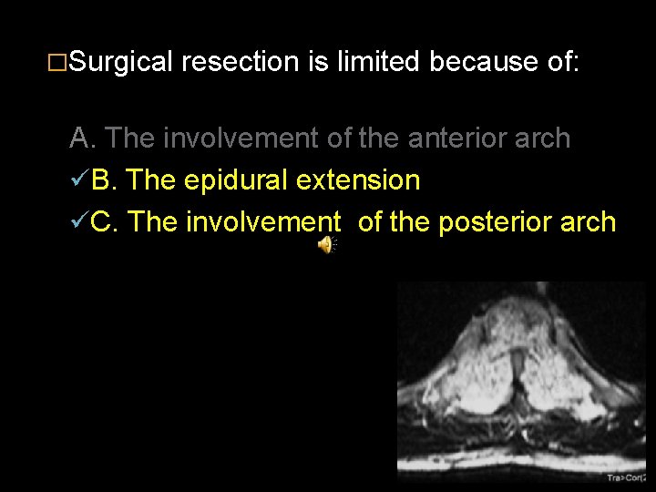 �Surgical resection is limited because of: A. The involvement of the anterior arch üB.