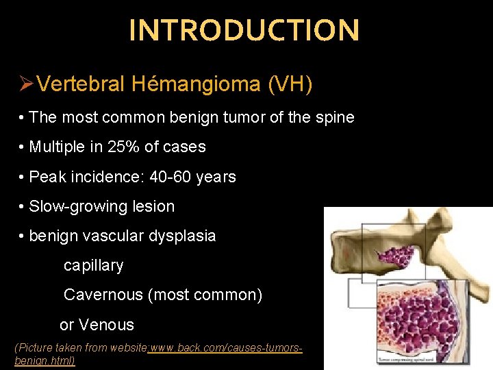 INTRODUCTION ØVertebral Hémangioma (VH) • The most common benign tumor of the spine •