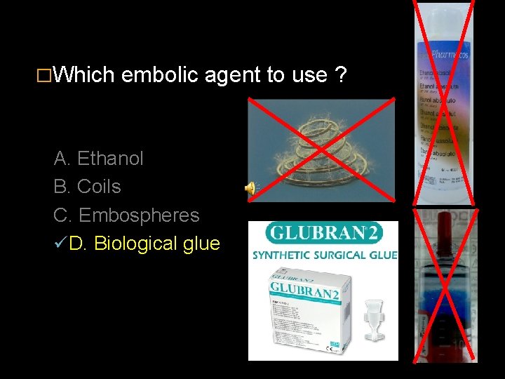 �Which embolic agent to use ? A. Ethanol B. Coils C. Embospheres ü D.