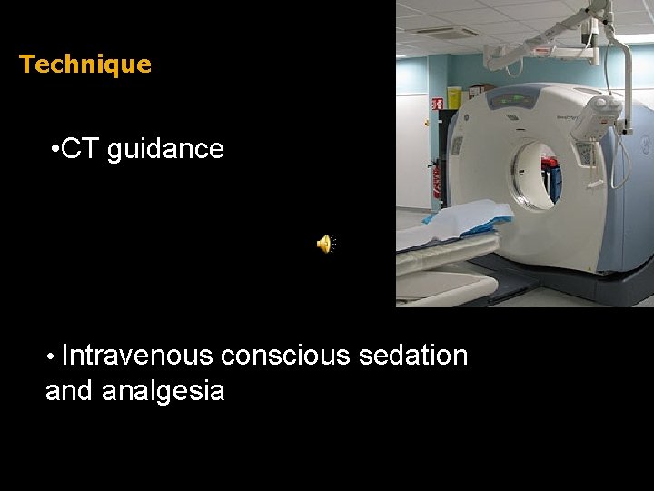 Technique • CT guidance • Intravenous conscious sedation and analgesia 