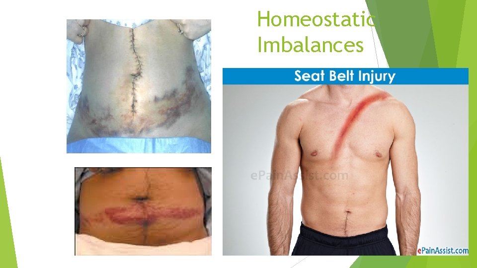 Homeostatic Imbalances 