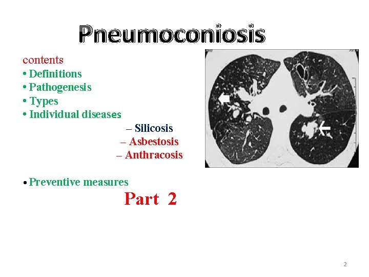 Pneumoconiosis contents • Definitions • Pathogenesis • Types • Individual diseases – Silicosis –
