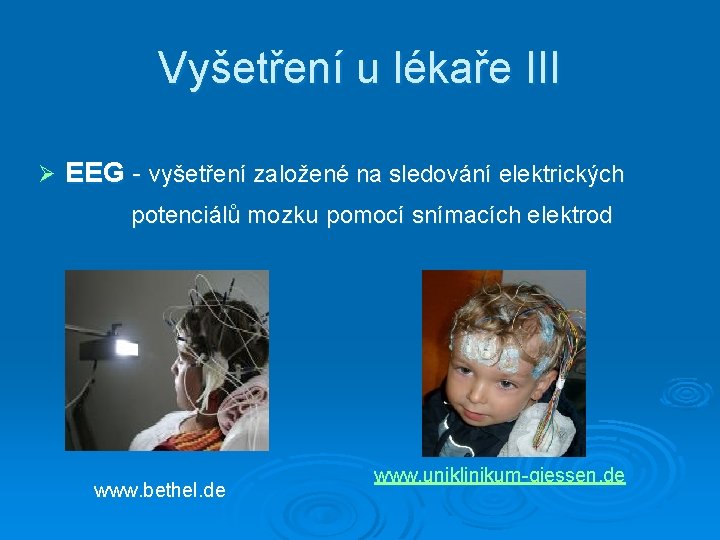 Vyšetření u lékaře III Ø EEG - vyšetření založené na sledování elektrických potenciálů mozku