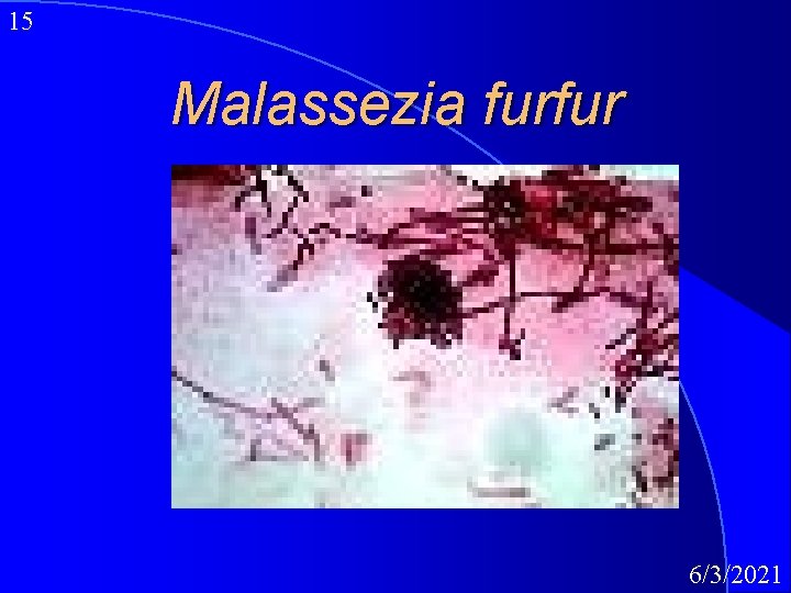 15 Malassezia furfur 6/3/2021 
