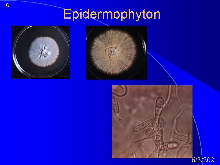 19 Epidermophyton 6/3/2021 