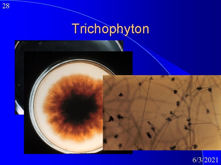 28 Trichophyton 6/3/2021 