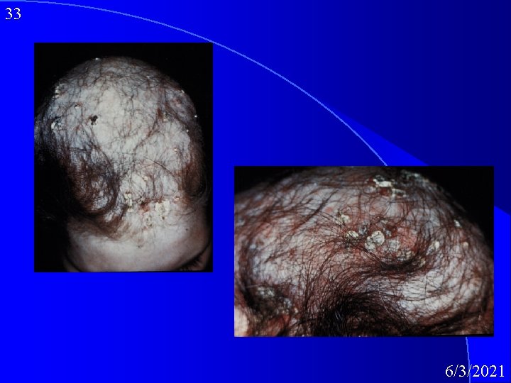 33 6/3/2021 
