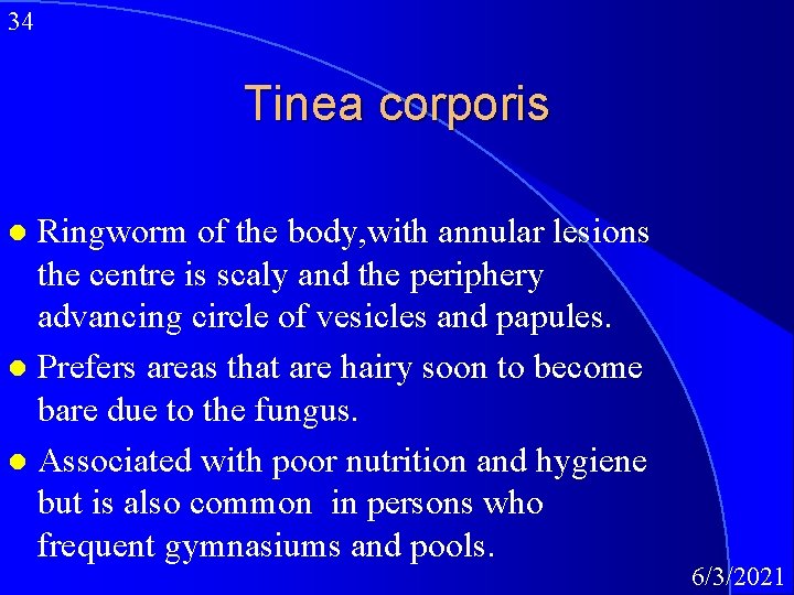 34 Tinea corporis Ringworm of the body, with annular lesions the centre is scaly