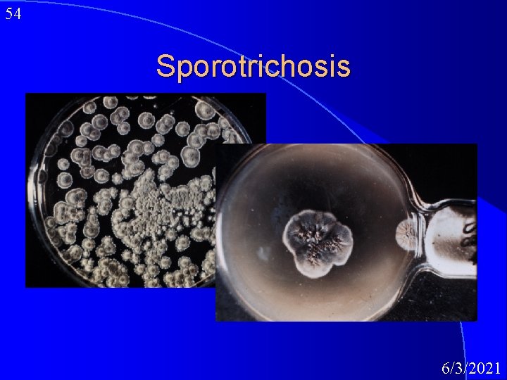 54 Sporotrichosis 6/3/2021 