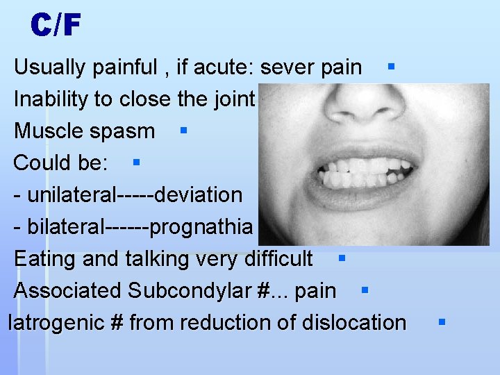 C/F Usually painful , if acute: sever pain § Inability to close the joint