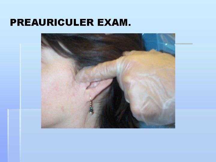 PREAURICULER EXAM. 