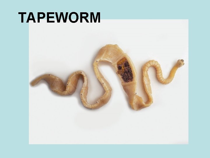 TAPEWORM 