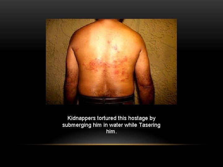 Kidnappers tortured this hostage by submerging him in water while Tasering him. 