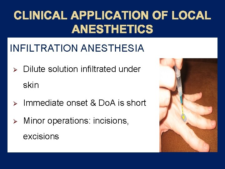 CLINICAL APPLICATION OF LOCAL ANESTHETICS INFILTRATION ANESTHESIA Ø Dilute solution infiltrated under skin Ø