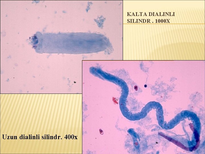 KALTA DIALINLI SILINDR. 1000 Х Uzun dialinli silindr. 400 х 