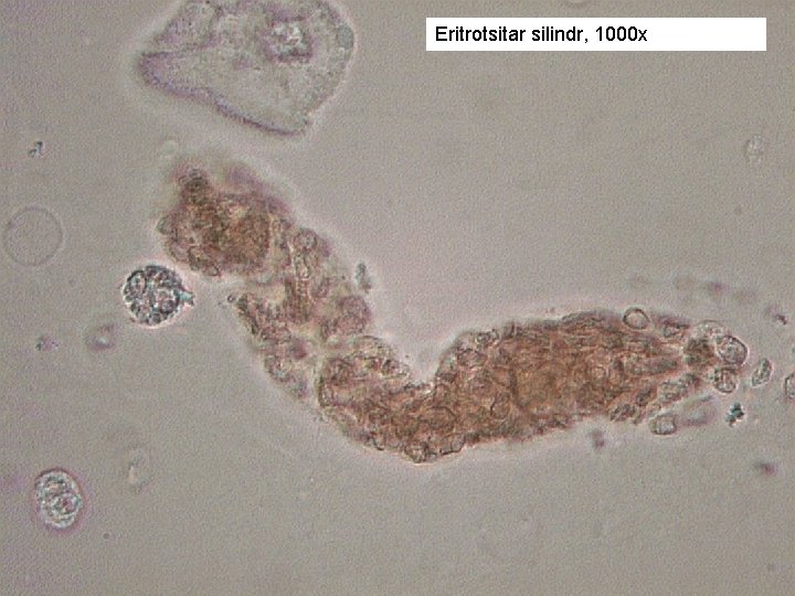 Eritrotsitar silindr, 1000 х 