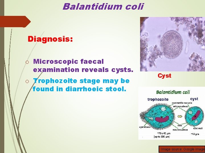 Balantidium coli Diagnosis: o Microscopic faecal examination reveals cysts. o Trophozoite stage may be