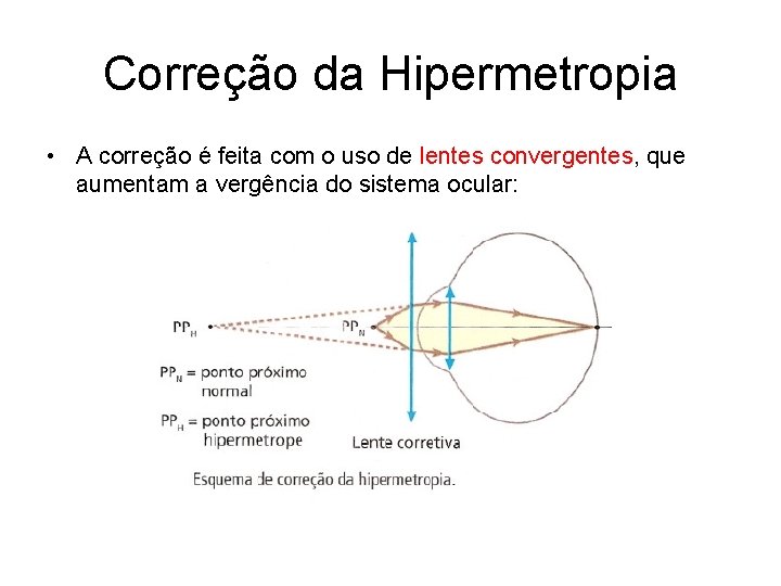 Correção da Hipermetropia • A correção é feita com o uso de lentes convergentes,