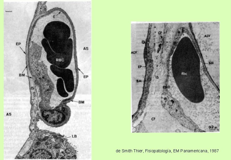 de Smith Thier, Fisiopatología, EM Panamericana, 1987 