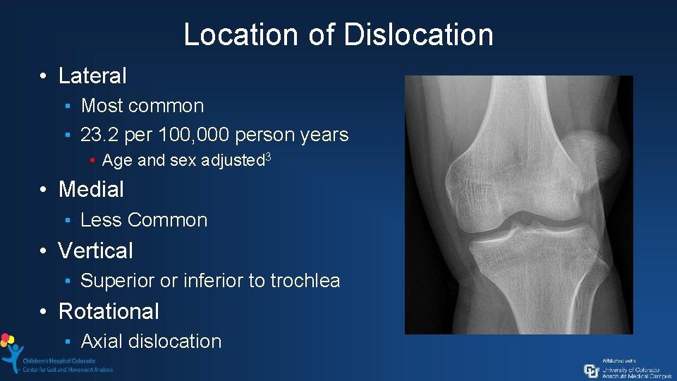 Location of Dislocation • Lateral ▪ Most common ▪ 23. 2 per 100, 000