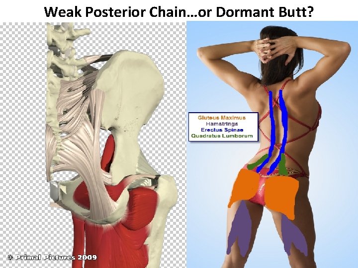 Weak Posterior Chain…or Dormant Butt? 