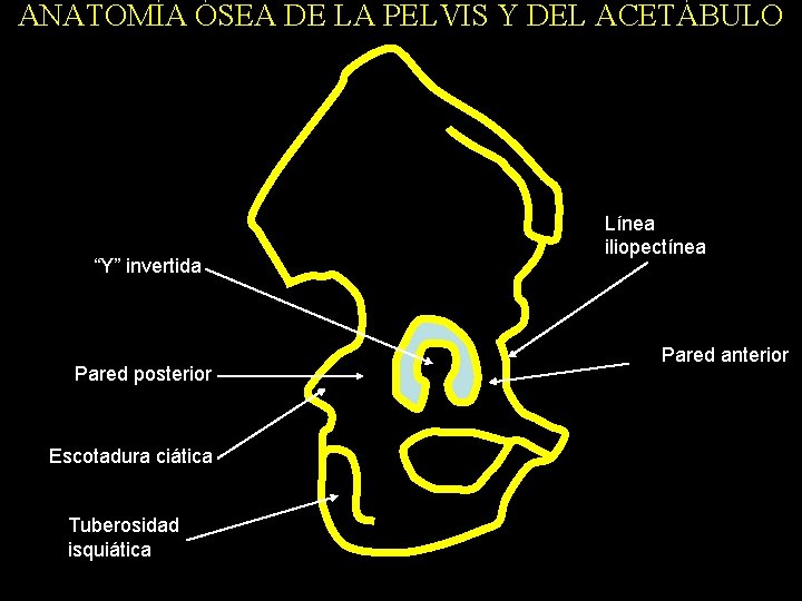 ANATOMÍA ÓSEA DE LA PELVIS Y DEL ACETÁBULO “Y” invertida Pared posterior Escotadura ciática