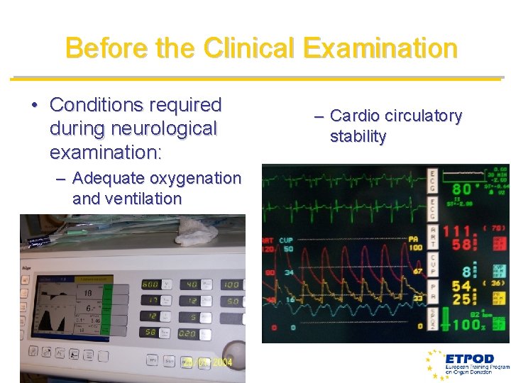 Before the Clinical Examination • Conditions required during neurological examination: – Adequate oxygenation and