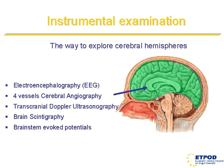 Instrumental examination The way to explore cerebral hemispheres § Electroencephalography (EEG) § 4 vessels