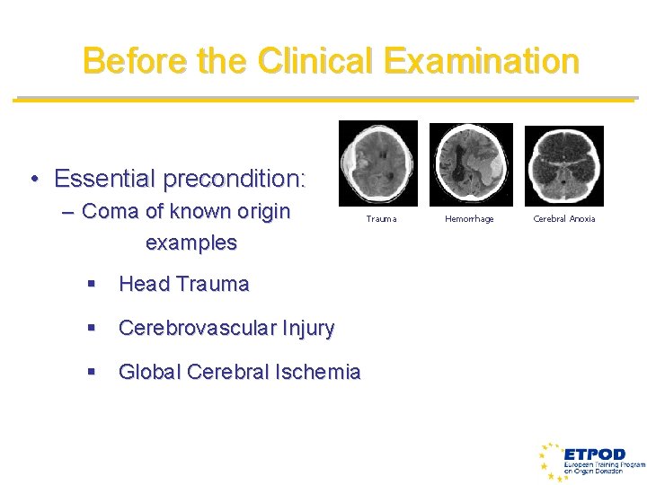 Before the Clinical Examination • Essential precondition: – Coma of known origin examples §