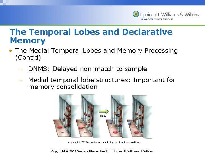The Temporal Lobes and Declarative Memory • The Medial Temporal Lobes and Memory Processing
